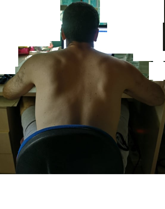 πλατη.png