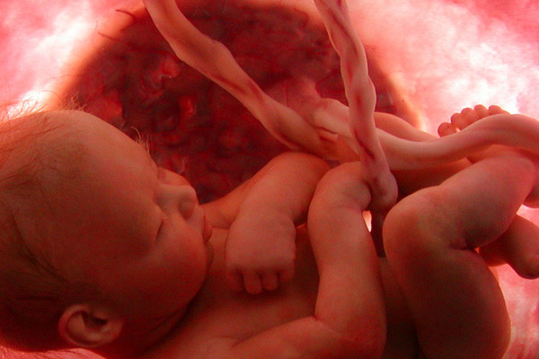 8-month-fetusjpg.jpg