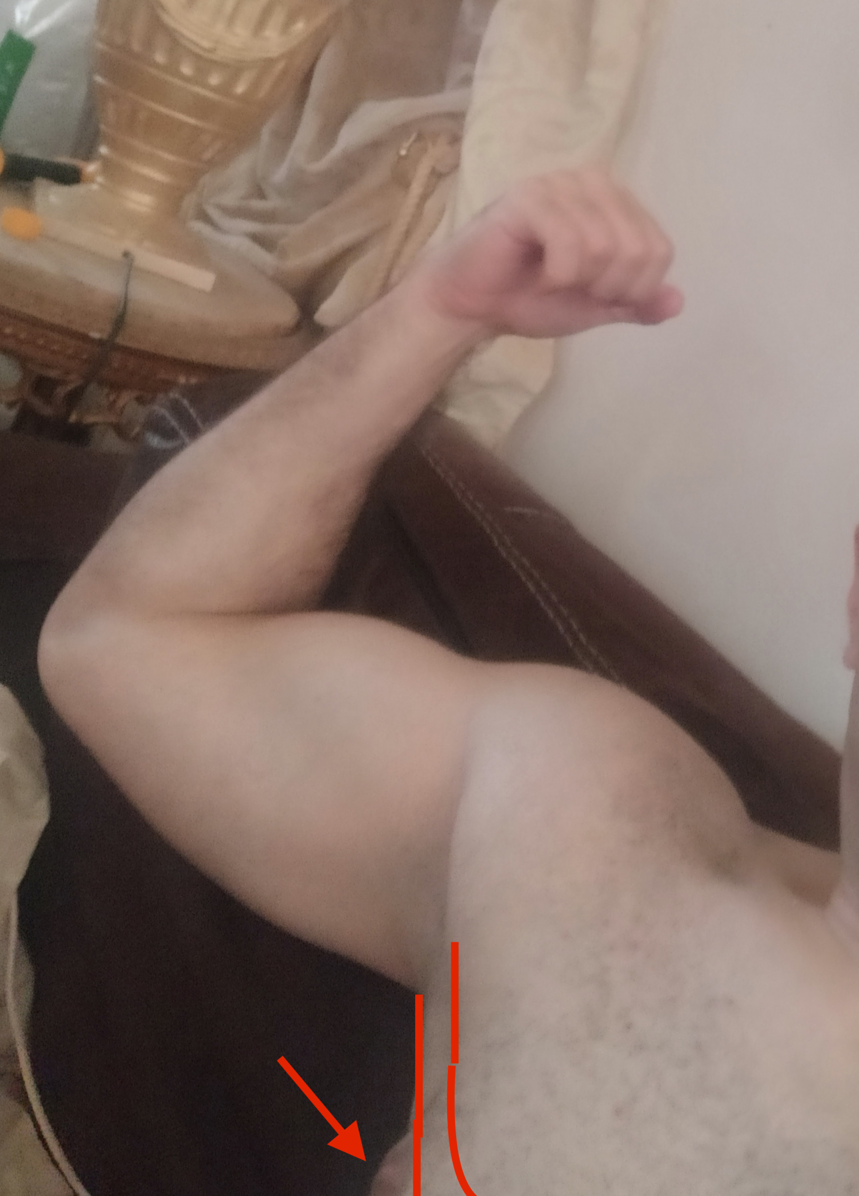 gyno.jpeg