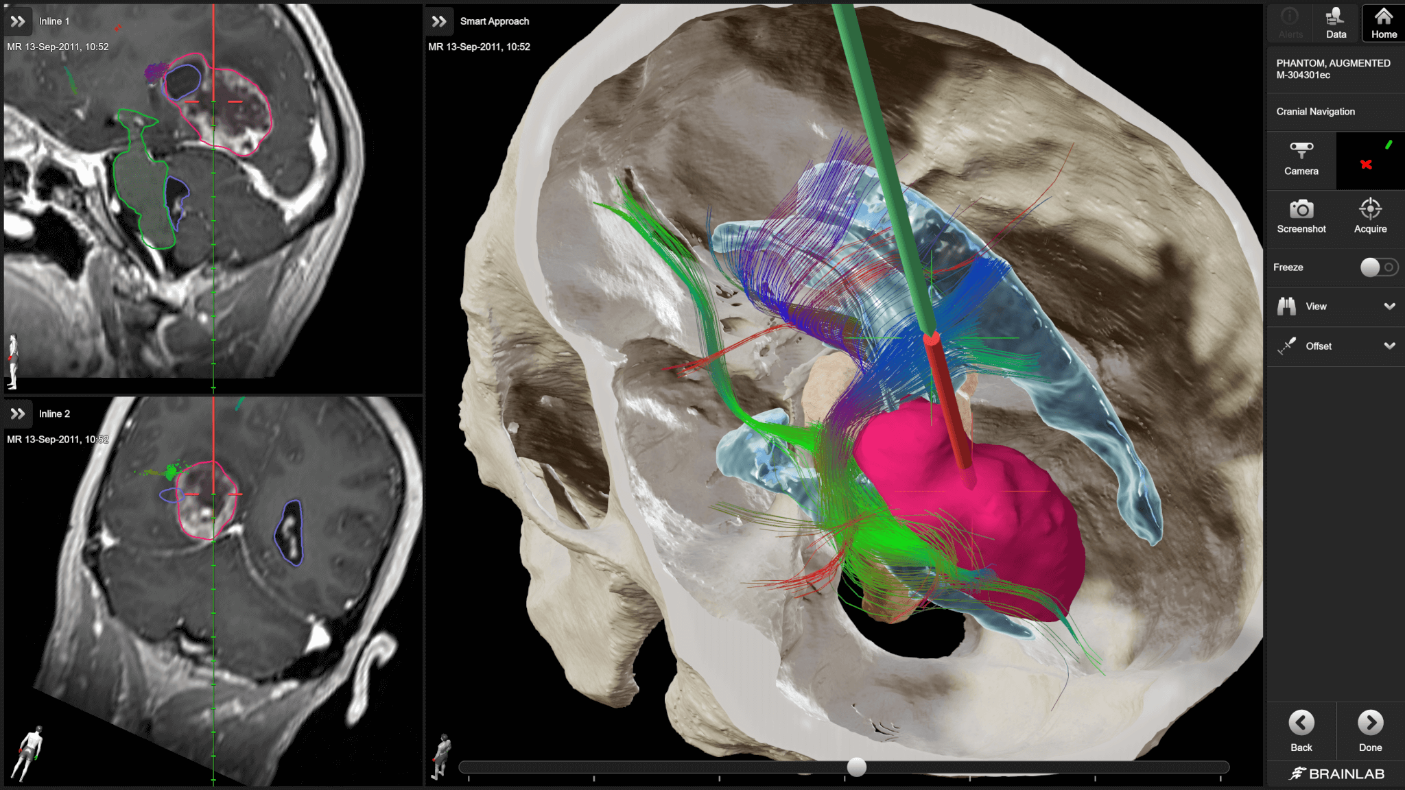 www.brainlab.com